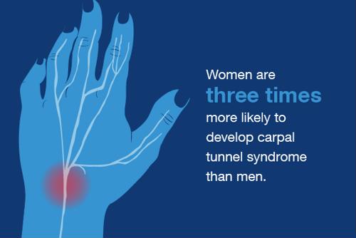 Surprising statistics about carpal tunnel syndrome
